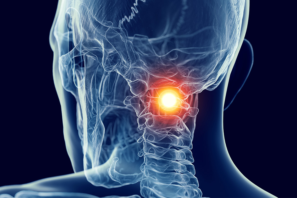 Upper cervical x-ray with pain in neck- Lighthouse Chiropractic and Wellness