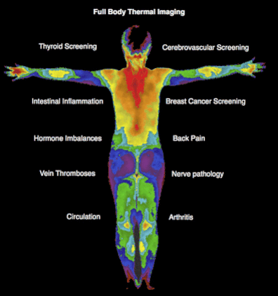 Full Body Thermography Scan